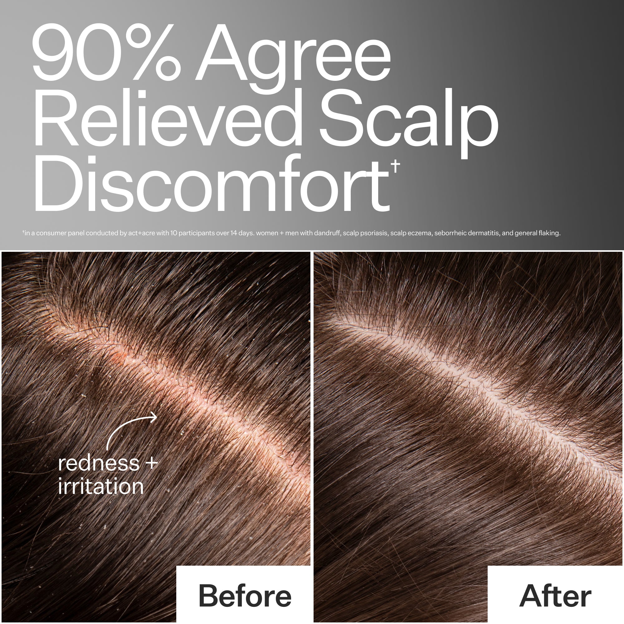 Act + Acre Microbiome Cooling Scalp Serum